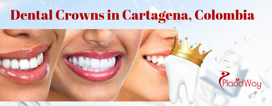 Dental Crowns in Cartagena, Colombia